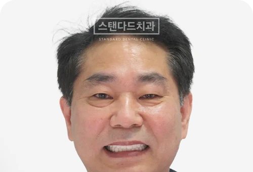 CASE 1 치료 후(AFTER) 사진