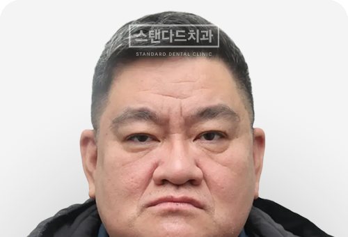 CASE 8 치료 전(BEFORE) 사진