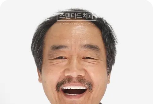 CASE 10 치료 후(AFTER) 사진