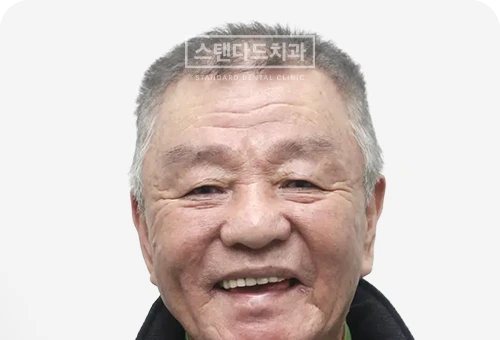 CASE 3 — 치료 후 정면 얼굴 사진(AFTER, 웃는 얼굴)