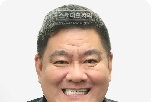 CASE 8 — 치료 후 정면 얼굴 사진(AFTER, 웃는 얼굴)