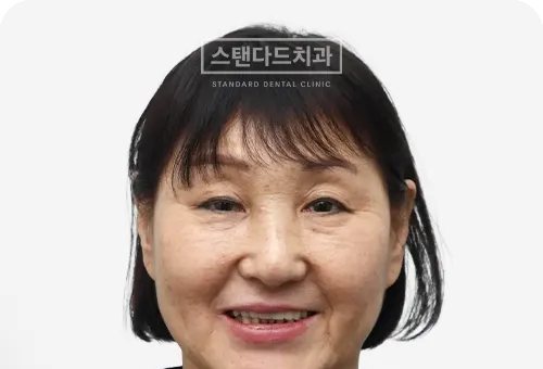 CASE 12 — 치료 후 정면 얼굴 사진(AFTER, 웃는 얼굴)