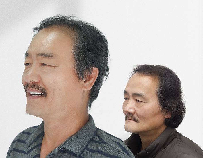같은 남성 환자의 치료 후(앞, 활짝 웃는 옆모습 — 2021.07.31)와 치료 전(뒤, 다문 입 — 2020.12.10) 사진